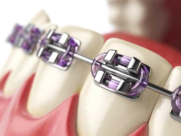 Качественное и удобное лечение в стоматологии Здоровье
