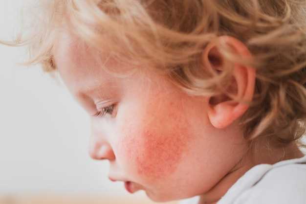 Лечение красных пупырышек в горле у ребенка