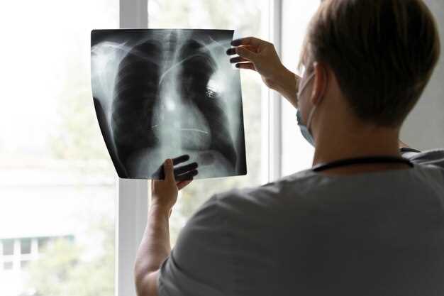 Метод рентгеновской диагностики при опухолях позвоночника
