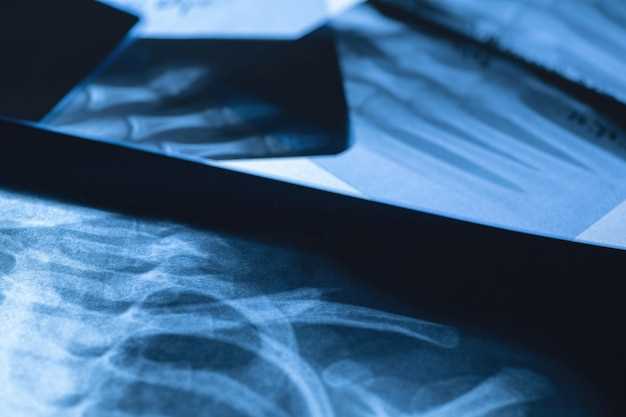 Опухоль позвоночника на рентгене: возможности и ограничения