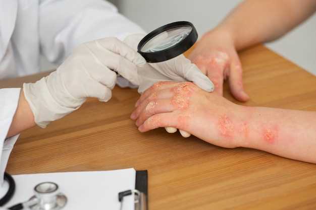 Папилломы у женщины: причины и лечение вирусных опухолей кожи