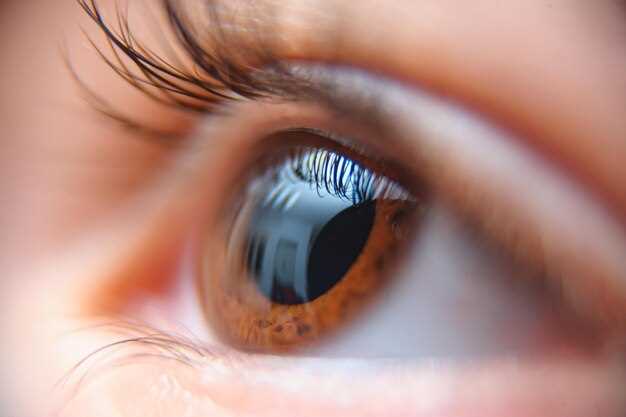 Диагностика, лечение и профилактика воспаления радужной оболочки глаза
