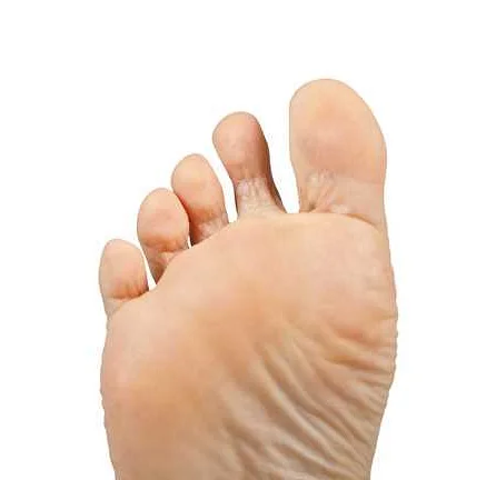 Symptoms of Toe Arthritis