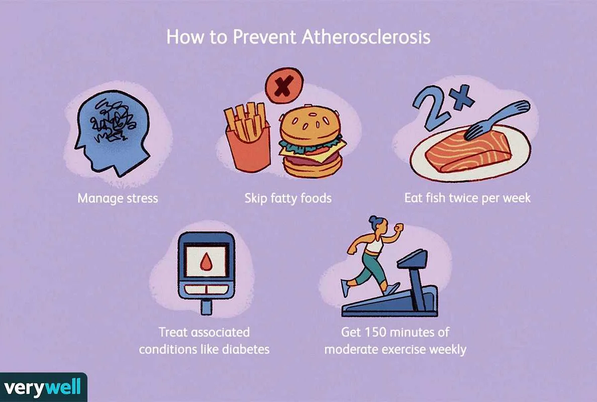 Common Symptoms of Atherosclerosis