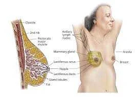 Types of Breast Cancer: Exploring Different Varieties