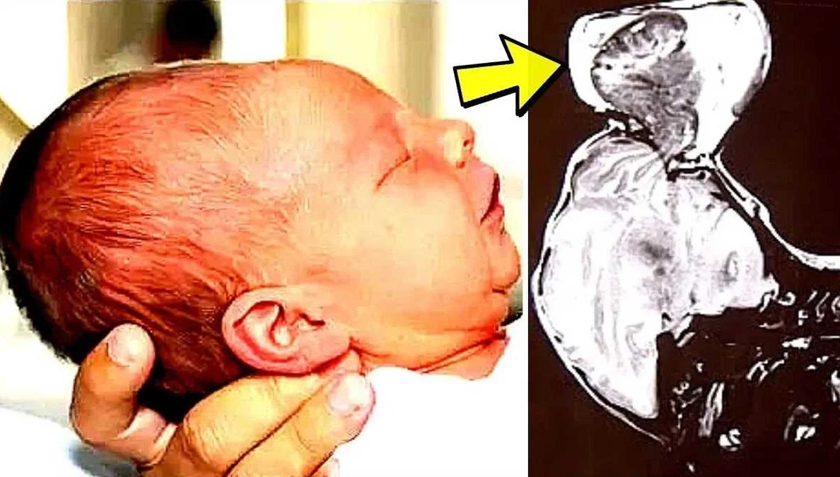 How Babies Form Emotional Attachments