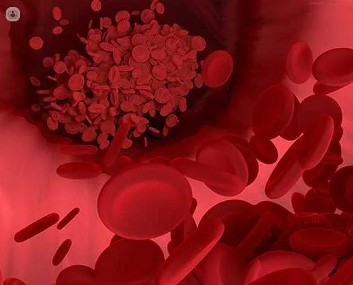 Genetic and Environmental Factors Affecting Blood Clotting