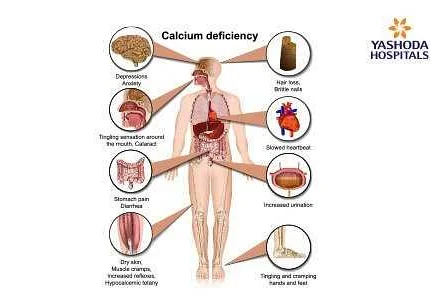 Symptoms of Excess Calcium