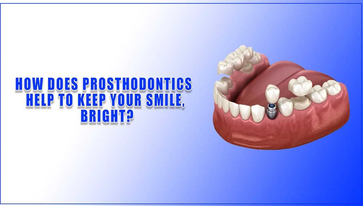 How Fixed Dental Prosthetics Work