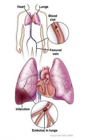 Diagnosis and Treatment Options