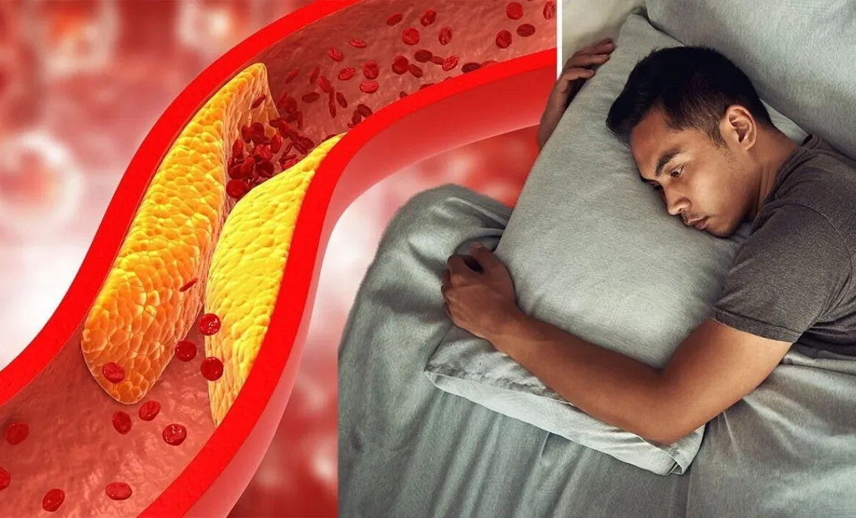 The Role of Sleep Deprivation in Increasing Cholesterol Levels