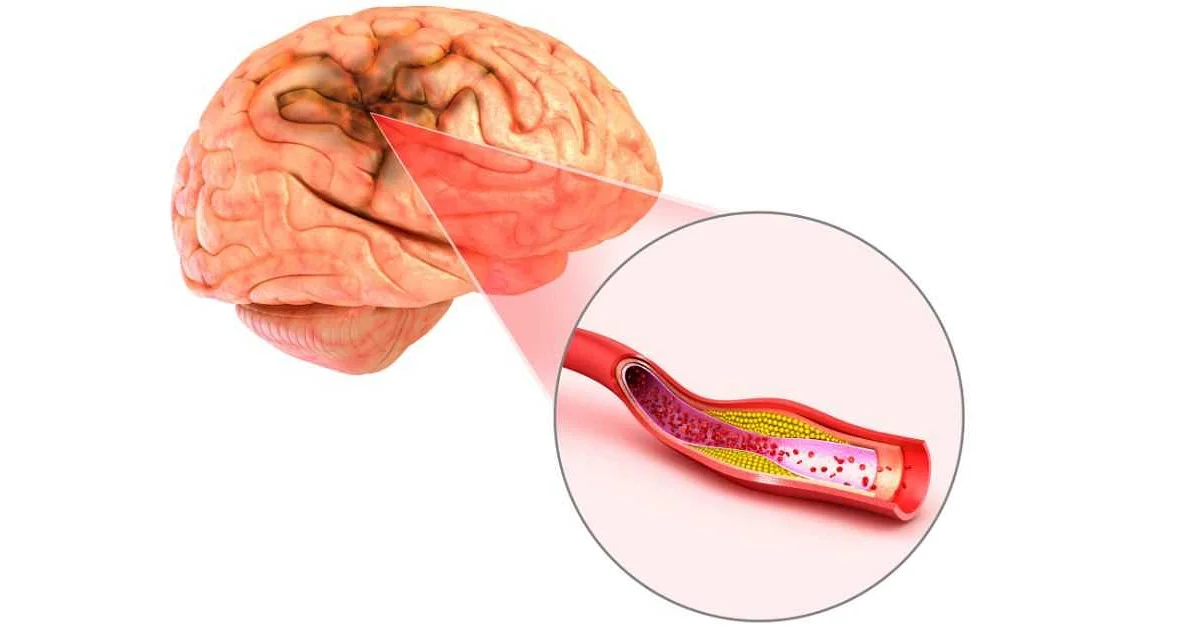 Key Symptoms to Watch Out For