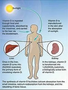 Hypervitaminosis D: Symptoms