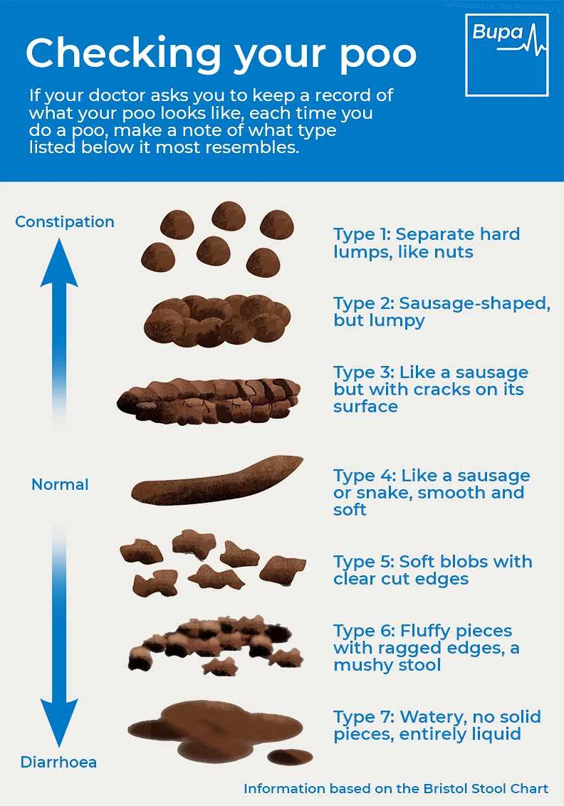 Possible Causes and Triggers of IBS