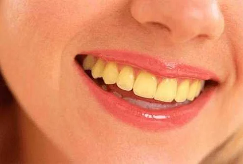 The Importance of Maintaining White Teeth