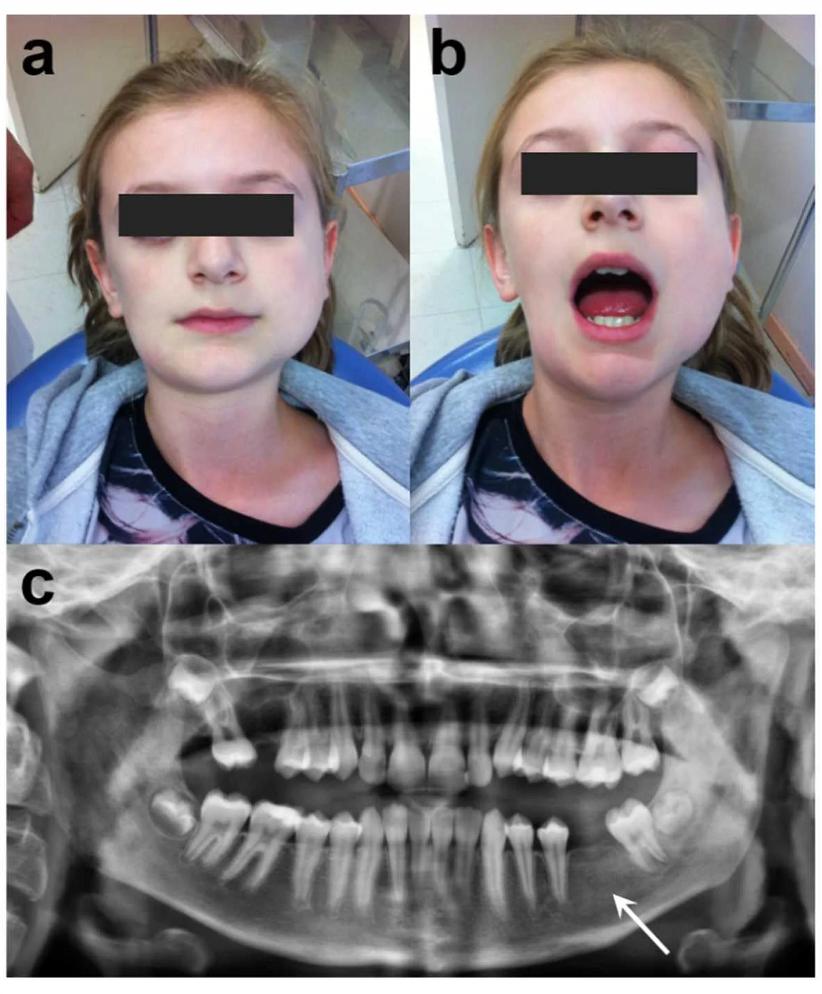 Understanding Jaw Jams