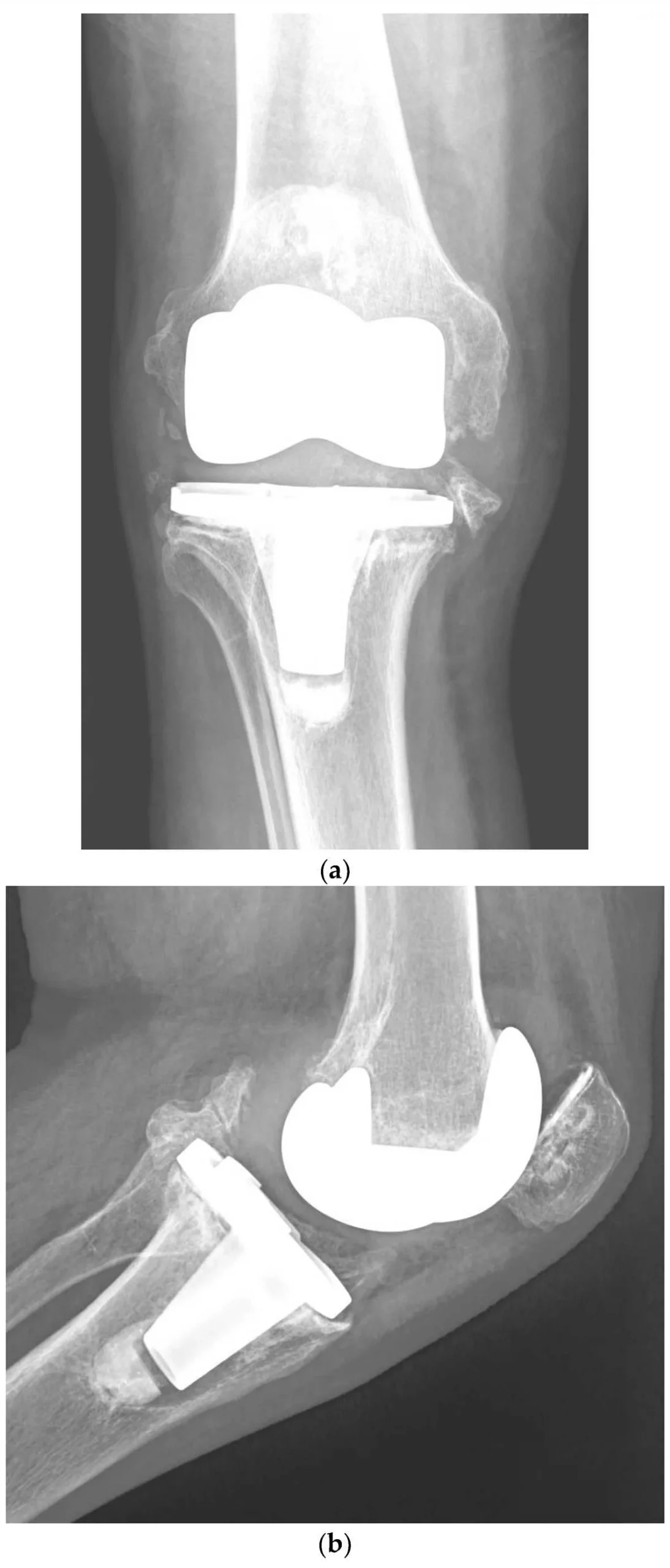 Simple Fractures, Korean Scientists