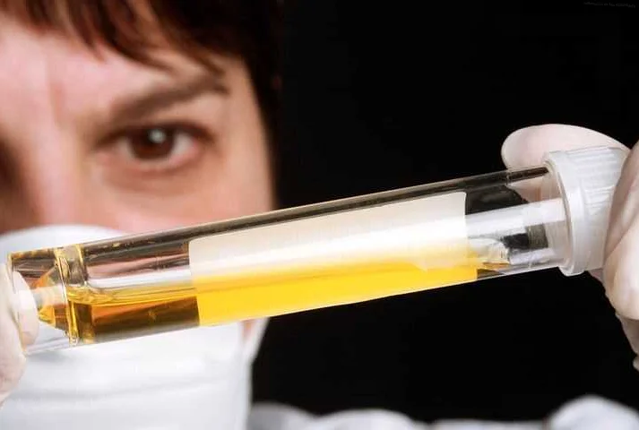 Breakthrough Research: Determining Life Expectancy through Urine Analysis