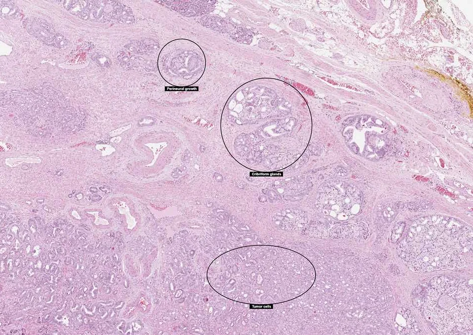 Exploring Prostate Secretion through Microscopy