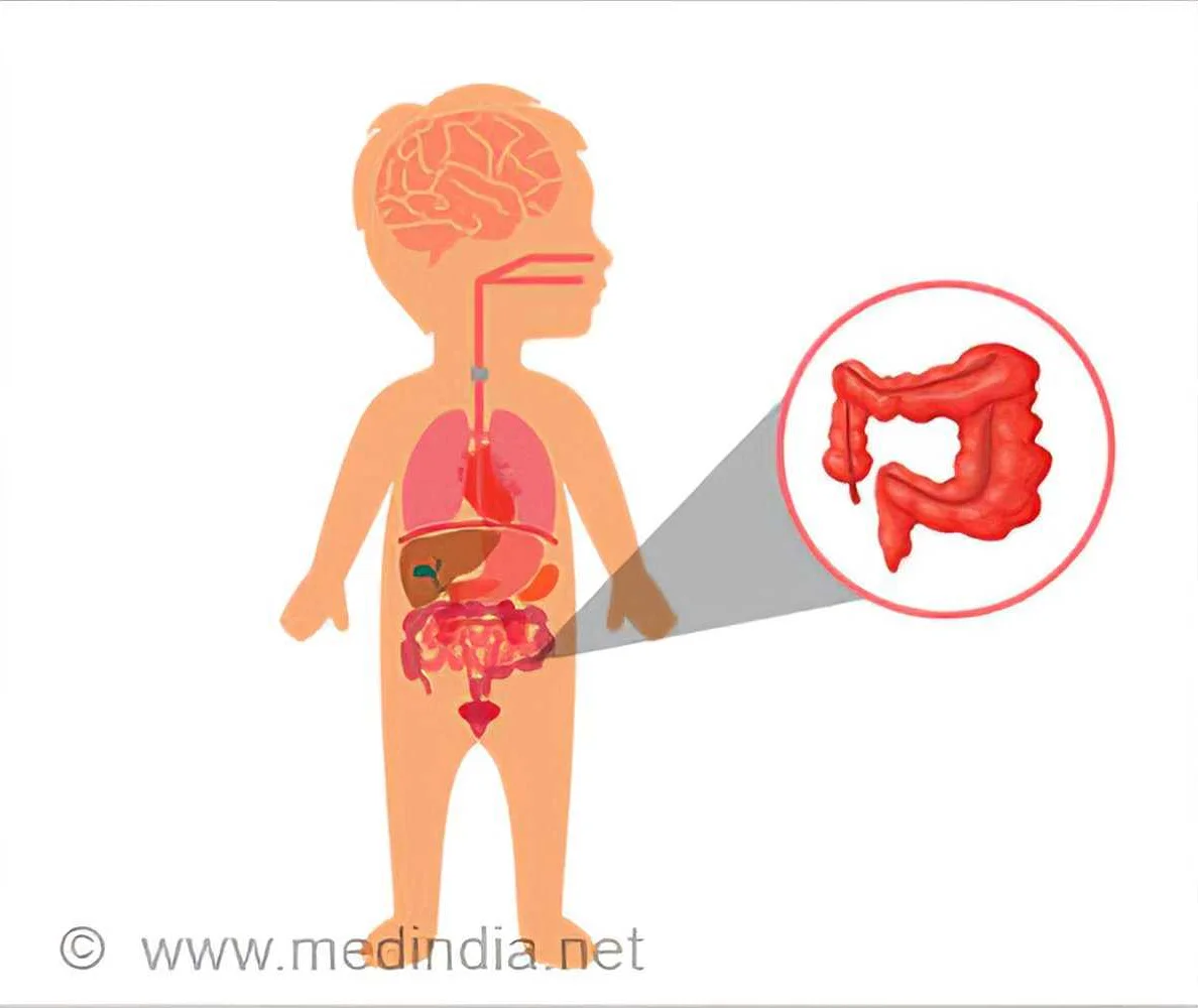 Common Symptoms of Necrotizing Enterocolitis