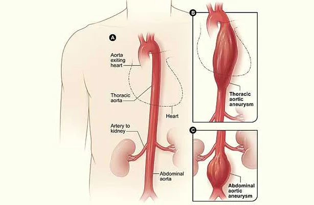 Causes and Risk Factors