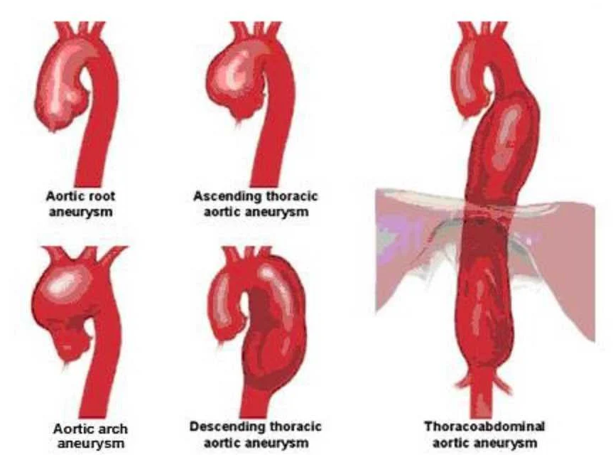 Treatment Options