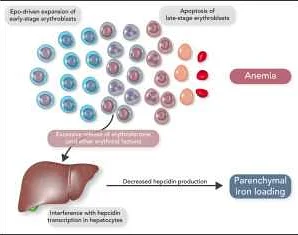 Common Symptoms Associated with Decreased Erythropoiesis