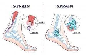 Diagnosis and Assessment of Sprains and Soft-Tissue Injuries