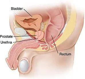 Preventing Prostatitis Pain