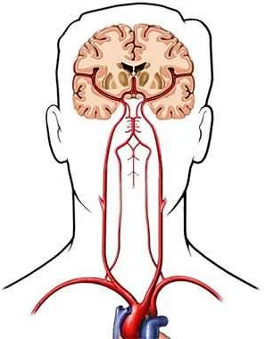 Common Causes of Syncope