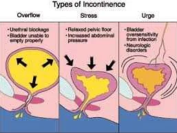 The Causes of Urinary Control Issues