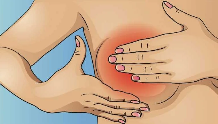 Muscle Strain and Breast Pain